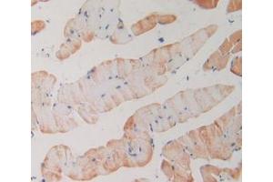 IHC-P analysis of Mouse Skeletal Muscle Tissue, with DAB staining. (PLA2R1 antibody  (AA 1418-1487))