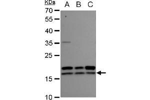 WB Image nm23-H2 antibody detects nm23-H2 protein by western blot analysis.