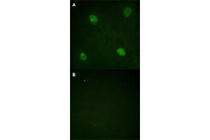 Immunofluorescence staining of methanol-fixed HeLa cells with HNRNPD (phospho S83) polyclonal antibody  without blocking peptide (A) or preincubated with blocking peptide (B) at 1:100-1:200 dilution.