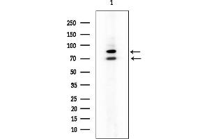 Western blot analysis of lysates from Rat spleen, using ACAD9 Mouse Monoclonal Antibody at 1/1000 dilution.