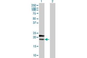 Western Blot analysis of PTTG1IP expression in transfected 293T cell line by PTTG1IP MaxPab polyclonal antibody.