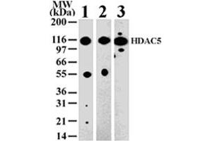 Western blot analysis of HDAC5 in 293 (lane 1) , Jurkat (lane 2) and NIH-3T3 (lane 3) cell lysate with HDAC5 polyclonal antibody  . (HDAC5 antibody  (AA 572-587))