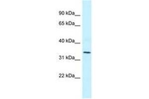 Image no. 1 for anti-Mitochondrial Ribosomal Protein L1 (MRPL1) (AA 51-100) antibody (ABIN6747858) (MRPL1 antibody  (AA 51-100))