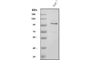 Western blot analysis of Tlr8 using anti-Tlr8 antibody (ABIN7603240).