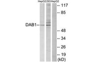 Western blot analysis of extracts from HepG2/293 cells, using Dab1 (Ab-232) Antibody. (DAB1 antibody  (AA 199-248))