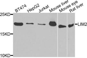 Western blot analysis of extracts of various cell lines, using LIM2 antibody. (LIM2 antibody)