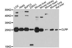 Western blot analysis of extracts of various cell lines, using CLPP antibody (ABIN5995818) at 1/1000 dilution. (CLPP antibody)