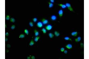 Immunofluorescence staining of Hela cells with ABIN7152772 at 1:96, counter-stained with DAPI. (FGF1 antibody  (AA 16-155))
