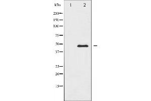 Western blot analysis of CaMK2 alpha/delta expression in NIH-3T3 whole cell lysates,The lane on the left is treated with the antigen-specific peptide. (CaMK2 alpha/delta antibody)