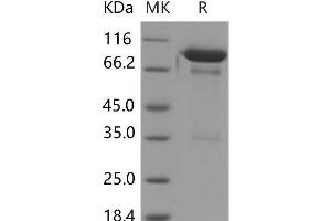 Western Blotting (WB) image for Immunoglobulin Superfamily, Member 8 (IGSF8) protein (Fc Tag) (ABIN7320065) (IGSF8 Protein (Fc Tag))