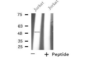 PPM1L antibody  (Internal Region)