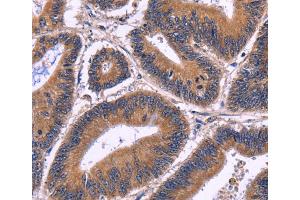 Immunohistochemistry (IHC) image for anti-Spermatogenesis Associated 7 (SPATA7) antibody (ABIN2428779)