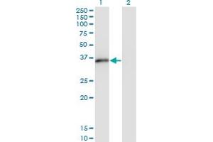 Western Blot analysis of MSX2 expression in transfected 293T cell line by MSX2 monoclonal antibody (M10A), clone 1E8. (Msx2/Hox8 antibody  (AA 1-133))
