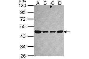 WB Image Sample (30 ug of whole cell lysate) A: 293T B: A431 , C: JurKat D: Raji 10% SDS PAGE antibody diluted at 1:1000 (NDUFS2 antibody  (Center))