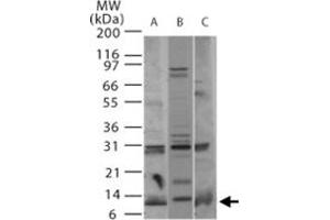 Western blot analysis of Pmaip1 in A) human, B) mouse, and C) rat thymus tissue using Pmaip1 polyclonal antibody  at 2 ug/mL . (NOXA antibody  (AA 51-66))