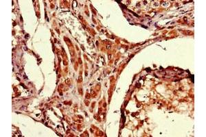 Immunohistochemistry of paraffin-embedded human testis tissue using ABIN7174691 at dilution of 1:100 (ARRDC1-AS1 (AA 1-176) antibody)