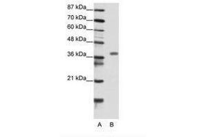 Image no. 1 for anti-Mesenchyme Homeobox 2 (MEOX2) (N-Term) antibody (ABIN202199)