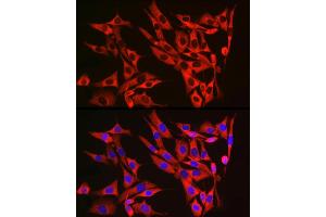 Immunofluorescence analysis of NIH/3T3 cells using RPL13 Rabbit mAb (ABIN7269993) at dilution of 1:50 (40x lens). (RPL13 antibody)