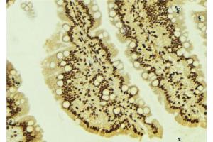 ABIN6272255 at 1/100 staining Mouse colon tissue by IHC-P.