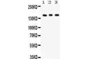 Anti- Insulin Receptor antibody, Western blotting All lanes: Anti Insulin Receptor at 0. (Insulin Receptor antibody  (C-Term))