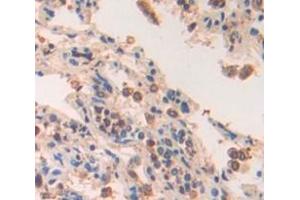 Figure. (USP8 antibody  (AA 777-1118))