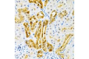 Immunohistochemistry of paraffin-embedded rat kidney using SULT2 Antibody (4063) at dilution of 1:200 (40x lens). (SULT2A1 antibody  (AA 1-145))