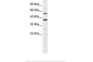 Image no. 2 for anti-A Kinase (PRKA) Anchor Protein 17A (AKAP17A) (AA 48-97) antibody (ABIN6735878) (SFRS17A antibody  (AA 48-97))