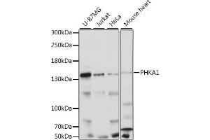 Western blot analysis of extracts of various cell lines, using PHK antibody (5700) at 1:1000 dilution. (PHKA1 antibody  (AA 600-820))