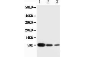 Anti-PF4 antibody, Western blotting Lane 1: Recombinant Human CXCL4 Protein 10ng Lane 2: Recombinant Human CXCL4 Protein 5ng Lane 3: Recombinant Human CXCL4 Protein 2. (PF4 antibody  (C-Term))