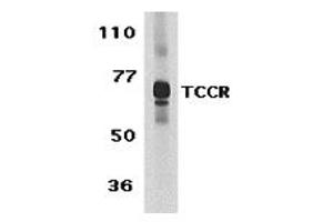 Western Blotting (WB) image for anti-Interleukin 27 Receptor, alpha (IL27RA) (C-Term) antibody (ABIN1030724) (IL27 Receptor alpha antibody  (C-Term))