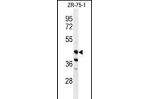Western blot analysis of FA2H Antibody (Center) (ABIN650994 and ABIN2840028) in ZR-75-1 cell line lysates (35 μg/lane). (FA2H antibody  (AA 121-148))