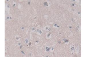 Detection of ANXA11 in Human Cerebrum Tissue using Polyclonal Antibody to Annexin A11 (ANXA11) (Annexin A11 antibody  (AA 1-505))