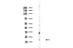 anti-Cancer/testis Antigen 2 (CTAG2) (Internal Region) antibody