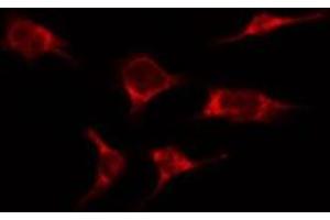 ABIN6276366 staining HepG2 by IF/ICC. (IL-2 antibody  (Internal Region))