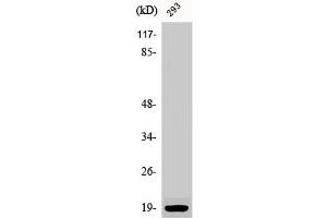 Western Blot analysis of 293 cells using Phospho-Op18 (S16) Polyclonal Antibody (Stathmin 1 antibody  (pSer16))