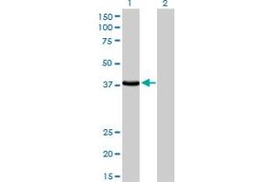 Western Blot analysis of EPM2A expression in transfected 293T cell line by EPM2A monoclonal antibody (M02), clone 6C6.