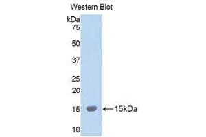 Western Blotting (WB) image for anti-Lysyl Oxidase-Like 2 (LOXL2) (AA 323-427) antibody (ABIN1859684) (LOXL2 antibody  (AA 323-427))