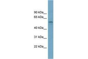 SLC22A15 antibody  (AA 359-408)