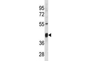 Txnip antibody western blot analysis in mouse stomach tissue lysate. (TXNIP antibody  (AA 116-145))
