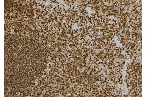 ABIN6277577 at 1/100 staining Mouse spleen tissue by IHC-P. (PRKRA antibody  (Internal Region))