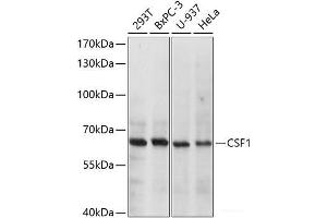 Western blot analysis of extracts of various cell lines using CSF1 Polyclonal Antibody at dilution of 1:1000. (M-CSF/CSF1 antibody)