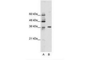 Image no. 1 for anti-Zinc Finger Protein 124 (ZNF124) (N-Term) antibody (ABIN202167) (ZNF124 antibody  (N-Term))