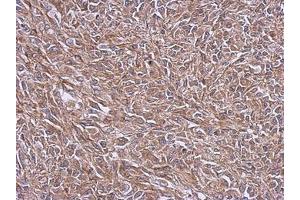 Image no. 1 for anti-NADH Dehydrogenase (Ubiquinone) 1 beta Subcomplex, 4, 15kDa (NDUFB4) (AA 1-129) antibody (ABIN1501991)