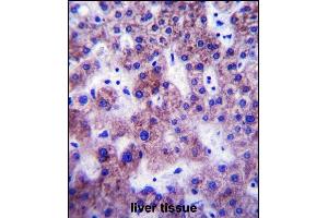 UGT1A1 Antibody (N-term) (ABIN657870 and ABIN2846826) immunohistochemistry analysis in formalin fixed and paraffin embedded human liver tissue followed by peroxidase conjugation of the secondary antibody and DAB staining. (UGT1A1 antibody  (N-Term))