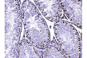 IHC analysis of MED8 using anti-MED8 antibody . (MED8 antibody  (AA 1-195))