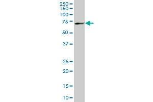 MBD1 monoclonal antibody (M02), clone 2C7. (MBD1 antibody  (AA 415-508))