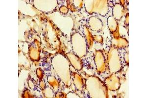 Immunohistochemistry of paraffin-embedded human thyroid tissue using ABIN7169807 at dilution of 1:100 (SLITRK6 antibody  (AA 621-821))