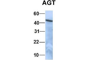 Host:  Rabbit  Target Name:  EGFL8  Sample Type:  HepG2  Antibody Dilution:  1. (AGT antibody  (N-Term))