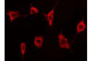 ABIN6273510 staining A549 cells by IF/ICC. (EIF4G2 antibody  (N-Term))
