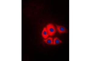 Immunofluorescent analysis of p130 Cas (pY249) staining in NIH3T3 cells. (BCAR1 antibody  (pTyr249))